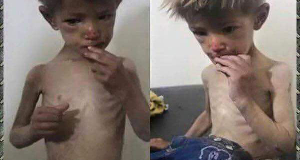   به‌ وێنه‌.. منداڵانی مه‌زایا له‌ برسان ده‌مرن